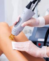 epilation au laser sur lyon My Laser Lyon - Epilation laser & Médecine esthétique